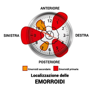 localizzazione delle emorroidi